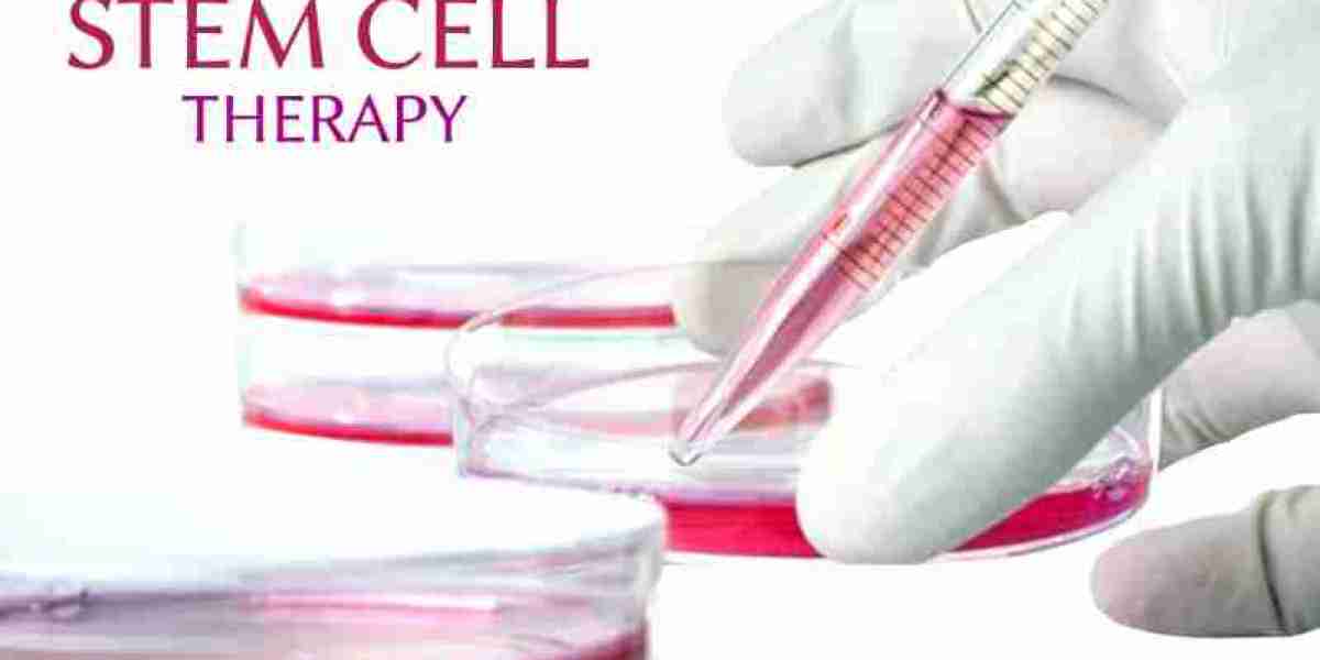 Role of Stem Cells in Modern Stroke Treatment