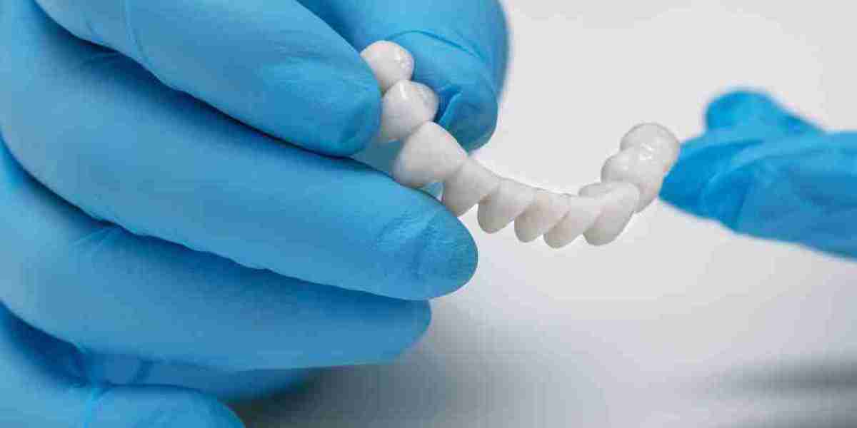 Crafting Perfection: How Custom Smile Design Solutions and Dental Crowns Revitalize Smiles