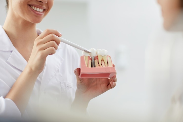 Top Reasons to Consider Orthodontic Treatment Richmond – @richmondfamily on Tumblr