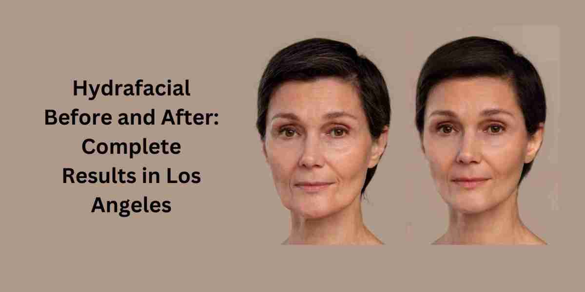 Hydrafacial Before and After: Complete Results in Los Angeles