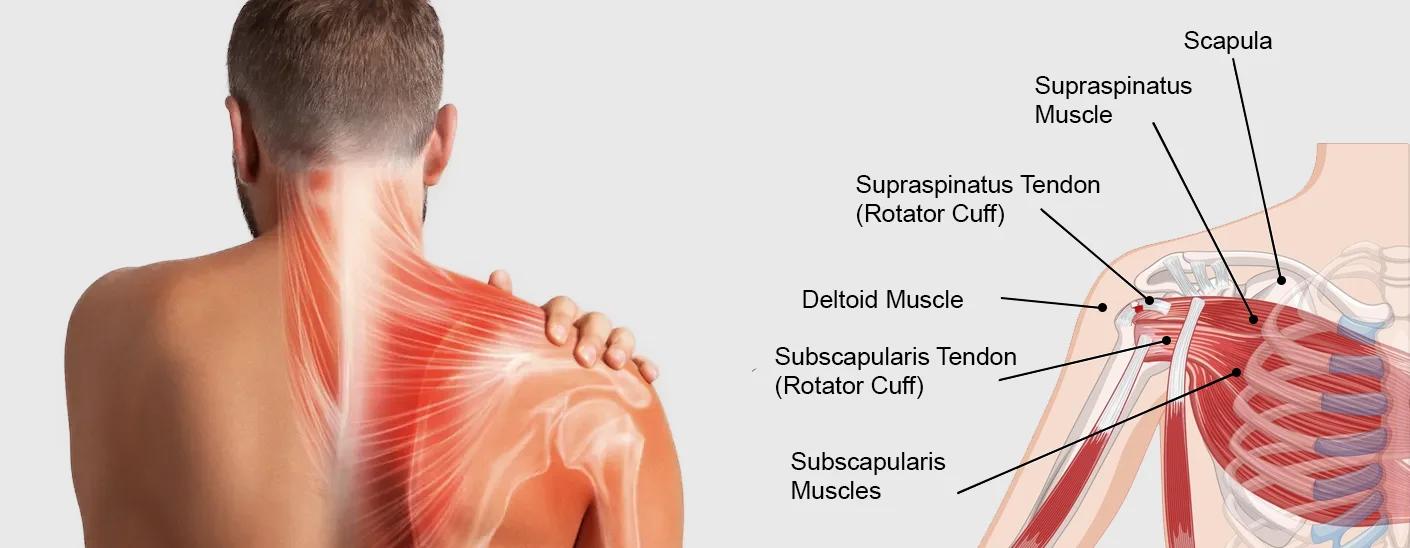 Female Shoulder Pain Diagnosis Chart