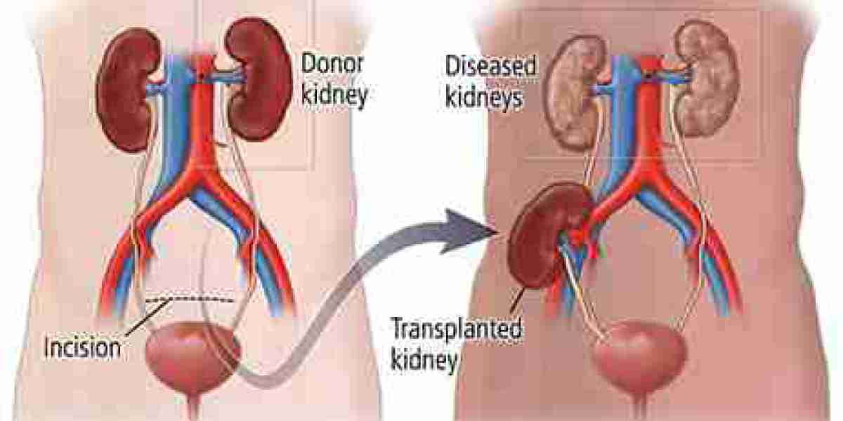 What are the top hospitals in Pune for kidney transplant surgery?