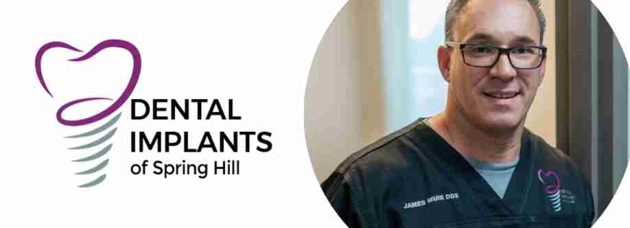 Dental Implants Spring Hill Cover Image