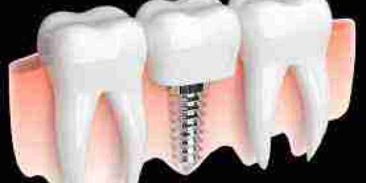 Dental Reestablishes Partake In Different Benefits